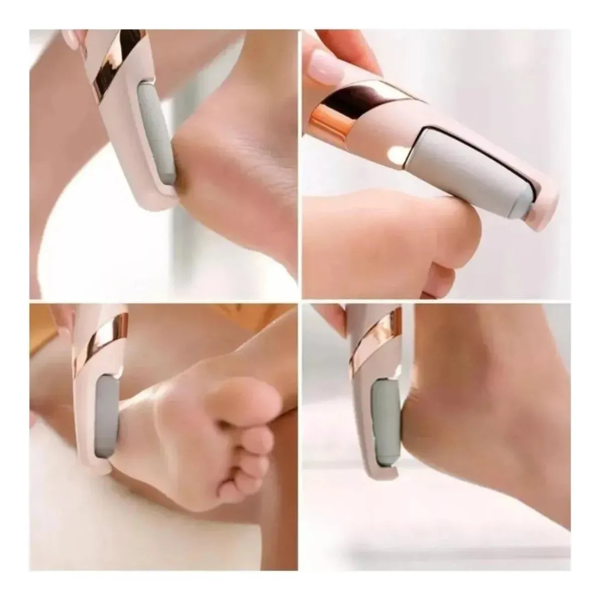 💥Removedor de Callos – ¡Pies Suaves en Minutos!