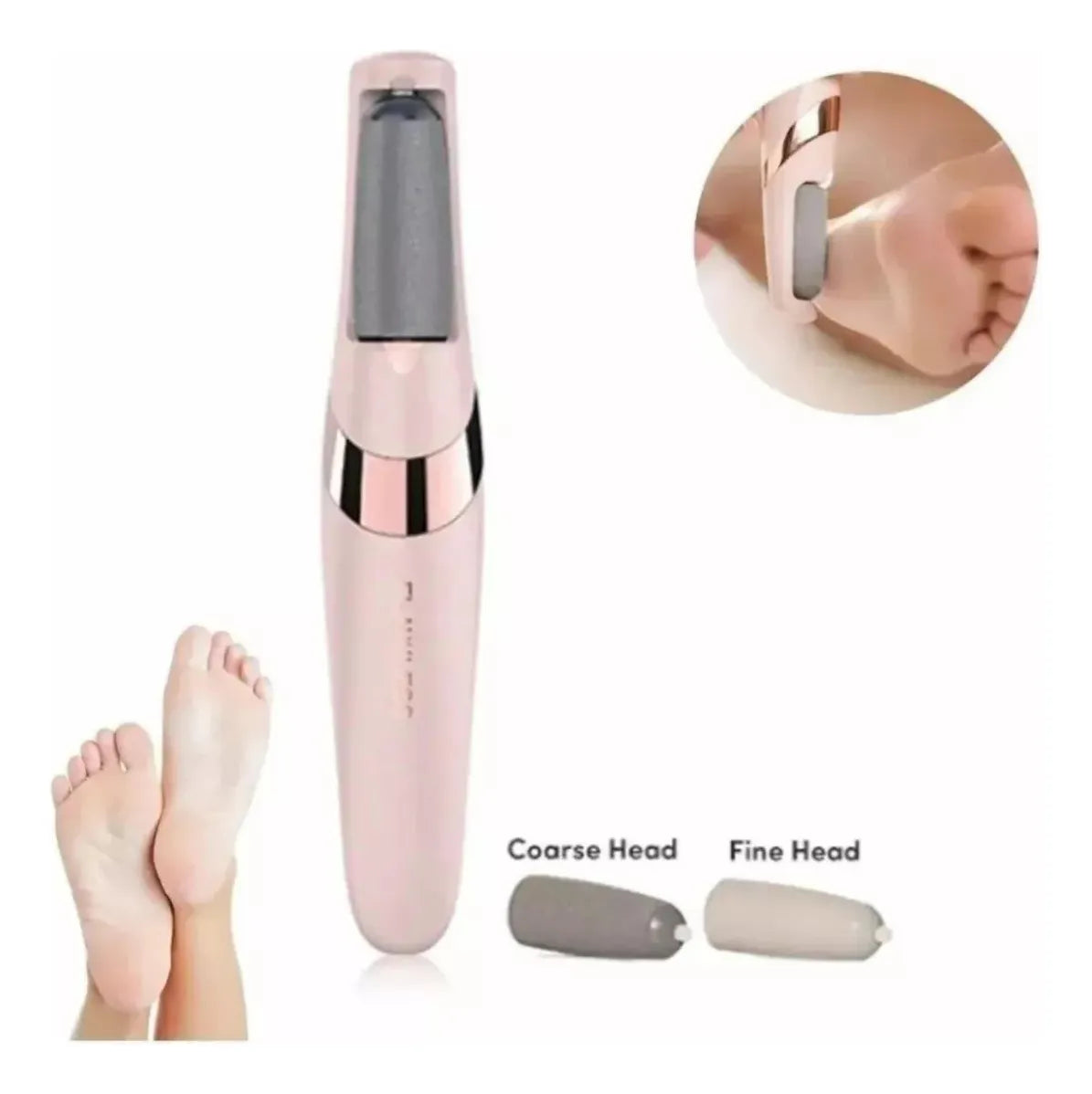 💥Removedor de Callos – ¡Pies Suaves en Minutos!